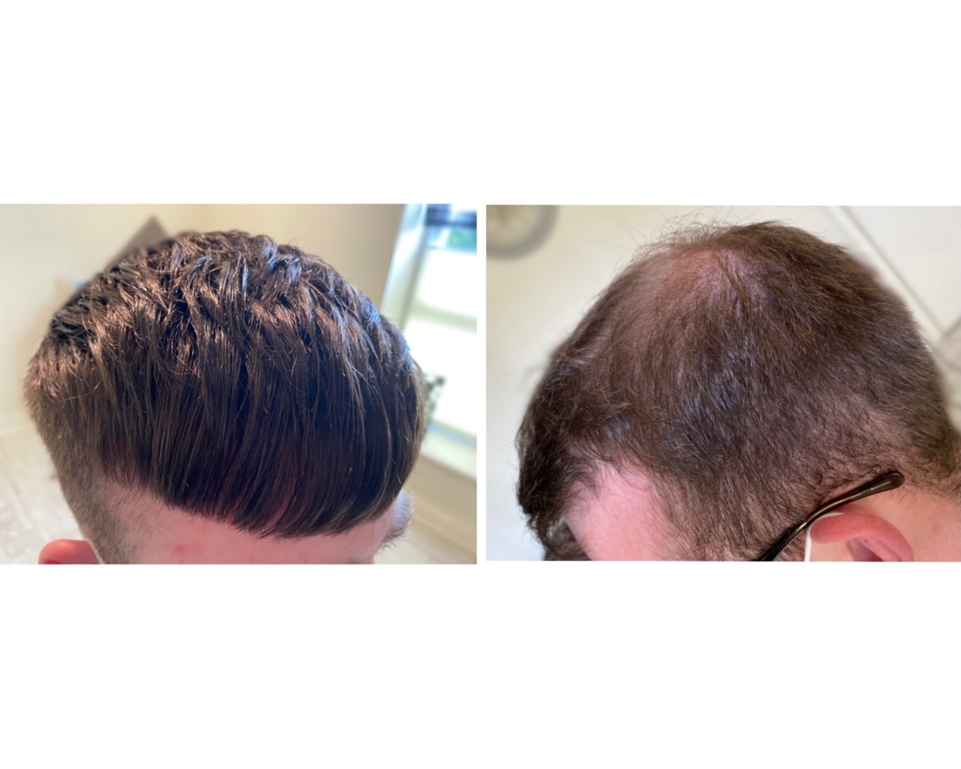 KA Hair Solutions before and after image